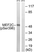 Anti-Phospho-MEF2C-Ser396 antibody (362-411 aa) (STJ90982) – Figure 1 of 1