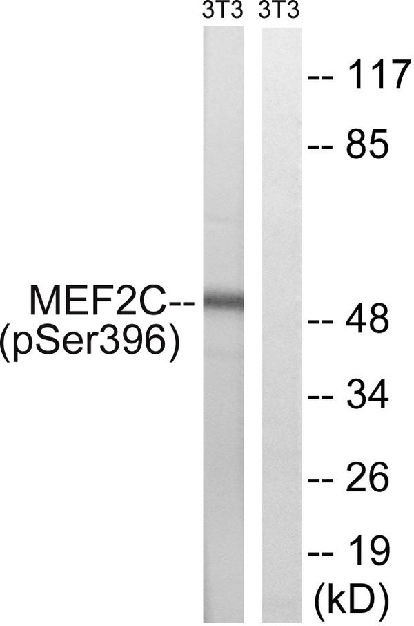 Anti-Phospho-MEF2C-Ser396 antibody (362-411 aa) (STJ90982) – Figure 1 of 1