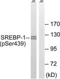 Anti-Phospho-SREBF1-Ser439 antibody (405-454 aa) (STJ90993) – Figure 1 of 1