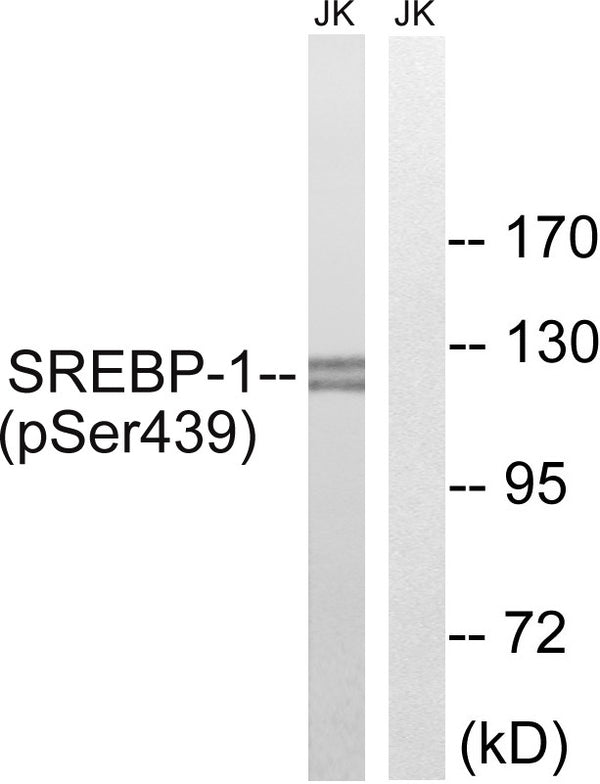Anti-Phospho-SREBF1-Ser439 antibody (405-454 aa) (STJ90993) – Figure 1 of 1