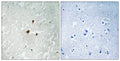 Anti-Phospho-RRN3-Ser649 antibody (602-651 aa) (STJ90994) – Figure 1 of 1