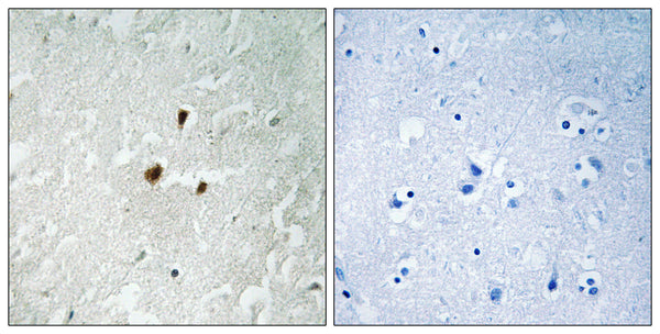 Anti-Phospho-RRN3-Ser649 antibody (602-651 aa) (STJ90994) – Figure 1 of 1