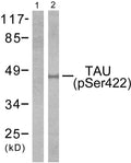 Anti-Phospho-MAPT-Ser422 antibody (706-755 aa) (STJ91005) – Figure 1 of 1