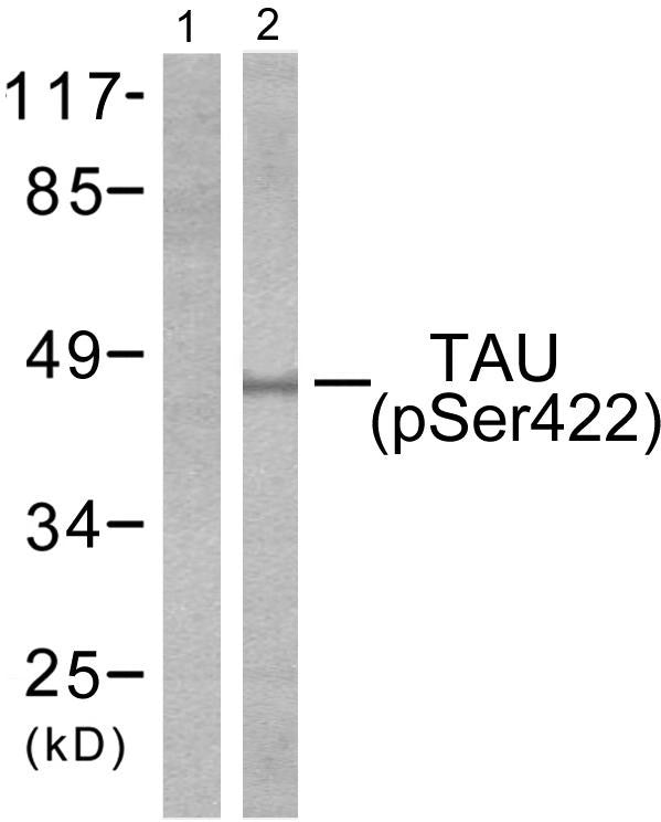 Anti-Phospho-MAPT-Ser422 antibody (706-755 aa) (STJ91005) – Figure 1 of 1