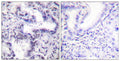 Anti-Phospho-XRCC5-Thr714 antibody (683-732 aa) (STJ91033) – Figure 1 of 1