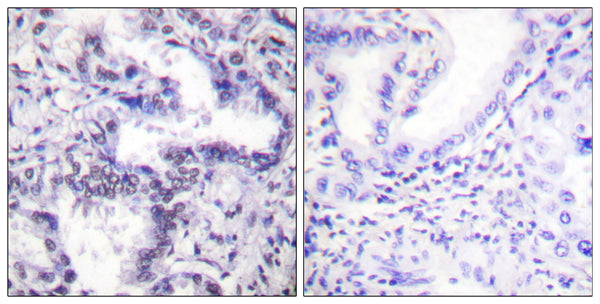 Anti-Phospho-XRCC5-Thr714 antibody (683-732 aa) (STJ91033) – Figure 1 of 1