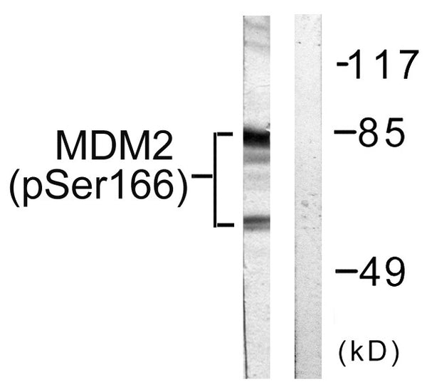 Anti-Phospho-MDM2-Ser166 antibody (132-181 aa) (STJ91043) – Figure 1 of 1