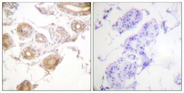 Anti-Phospho-BMX-Tyr40 antibody (6-55 aa) (STJ91059) – Figure 1 of 1