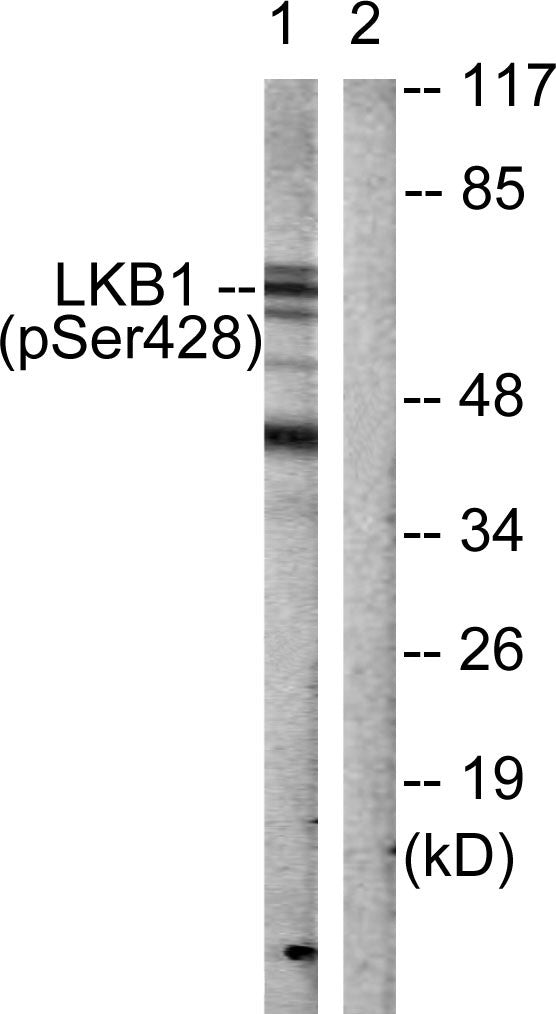 Anti-Phospho-STK11-Ser428 antibody (384-433 aa) (STJ91060) – Figure 1 of 1