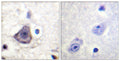 Anti-Phospho-ERBB3-Tyr1222 antibody (1191-1240 aa) (STJ91083) – Figure 1 of 1