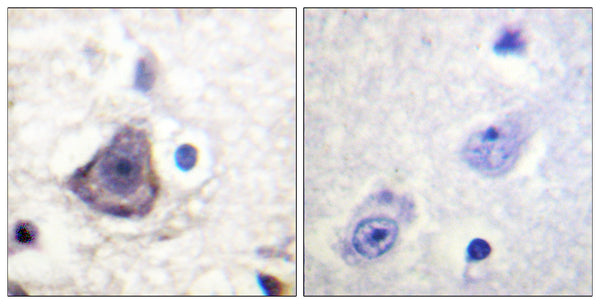 Anti-Phospho-ERBB3-Tyr1222 antibody (1191-1240 aa) (STJ91083) – Figure 1 of 1