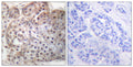 Anti-Phospho-Stat5a/b-Ser726/731 antibody (696-745 aa) (STJ91088) – Figure 1 of 1