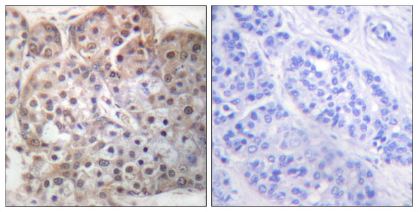 Anti-Phospho-Stat5a/b-Ser726/731 antibody (696-745 aa) (STJ91088) – Figure 1 of 1