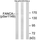 Anti-Phospho-FANCA-Ser1149 antibody (1121-1170 aa) (STJ91103) – Figure 1 of 1