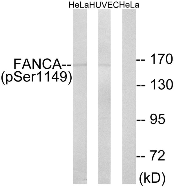 Anti-Phospho-FANCA-Ser1149 antibody (1121-1170 aa) (STJ91103) – Figure 1 of 1