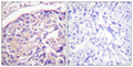 Anti-Phospho-TSC2-Thr1462 antibody (1428-1477 aa) (STJ91128) – Figure 1 of 1