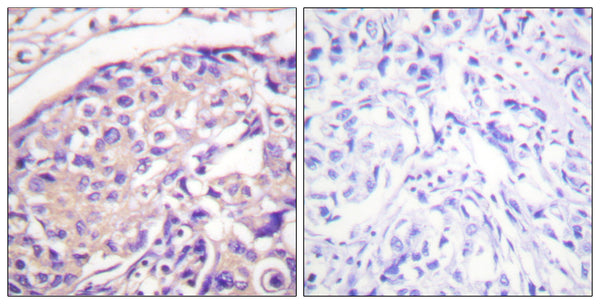 Anti-Phospho-TSC2-Thr1462 antibody (1428-1477 aa) (STJ91128) – Figure 1 of 1