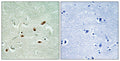 Anti-Phospho-PRKDC-Ser2612 antibody (2578-2627 aa) (STJ91146) – Figure 1 of 1