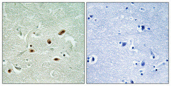 Anti-Phospho-PRKDC-Ser2612 antibody (2578-2627 aa) (STJ91146) – Figure 1 of 1