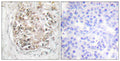 Anti-Phospho-PRKDC-Ser2056 antibody (2022-2071 aa) (STJ91147) – Figure 1 of 1