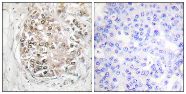 Anti-Phospho-PRKDC-Ser2056 antibody (2022-2071 aa) (STJ91147) – Figure 1 of 1