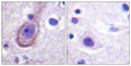 Anti-Phospho-KCNQ2/3/4/5-Thr217/246/223/251 antibody (191-240 aa) (STJ91166) – Figure 1 of 1