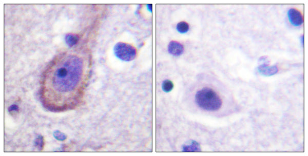 Anti-Phospho-KCNQ2/3/4/5-Thr217/246/223/251 antibody (191-240 aa) (STJ91166) – Figure 1 of 1