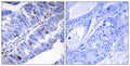 Anti-Phospho-NR4A1-Ser351 antibody (317-366 aa) (STJ91179) – Figure 1 of 1