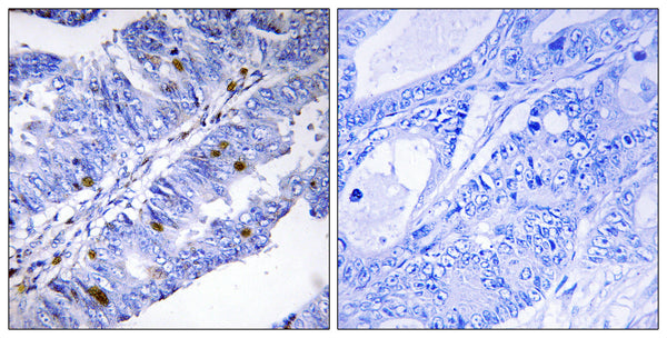 Anti-Phospho-NR4A1-Ser351 antibody (317-366 aa) (STJ91179) – Figure 1 of 1