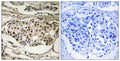 Anti-Phospho-RELA-Ser281 antibody (247-296 aa) (STJ91189) – Figure 1 of 1