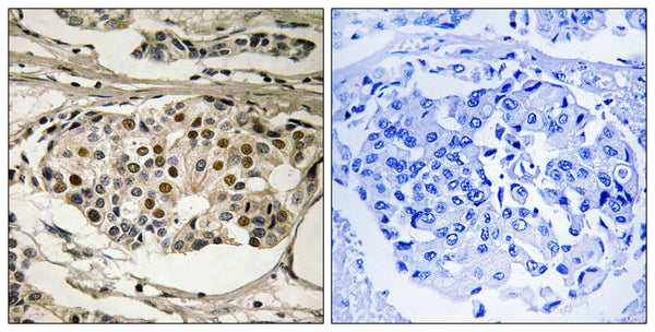 Anti-Phospho-RELA-Ser281 antibody (247-296 aa) (STJ91189) – Figure 1 of 1