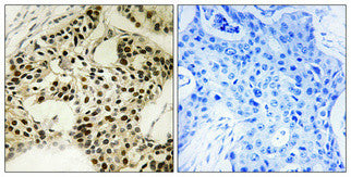 Anti-Phospho-STK11-Ser334 antibody (300-349 aa) (STJ91208) – Figure 1 of 1