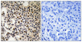 Anti-Phospho-PAK2-Ser197 antibody (163-212 aa) (STJ91214) – Figure 1 of 1