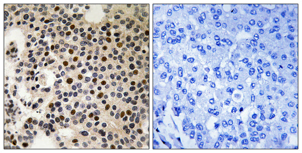 Anti-Phospho-PAK2-Ser197 antibody (163-212 aa) (STJ91214) – Figure 1 of 1