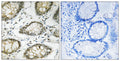 Anti-Phospho-ATR-Ser428 antibody (394-443 aa) (STJ91234) – Figure 1 of 1