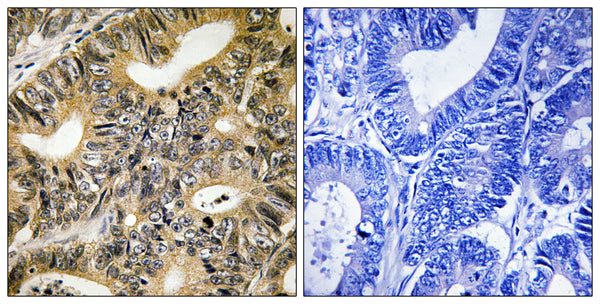 Anti-Phospho-EIF4EBP1-Thr70 antibody (36-85 aa) (STJ91237) – Figure 1 of 1