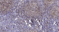 Anti-Phospho-CLDN4-Tyr208 antibody (160-209 aa) (STJ91248) – Figure 1 of 1