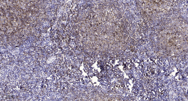 Anti-Phospho-CLDN4-Tyr208 antibody (160-209 aa) (STJ91248) – Figure 1 of 1