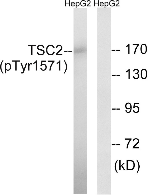 Anti-Phospho-TSC2-Tyr1571 antibody (1537-1586 aa) (STJ91276) – Figure 1 of 1