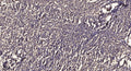 Anti-Phospho-BCL2-Thr74 antibody (STJ91281) – Figure 1 of 1