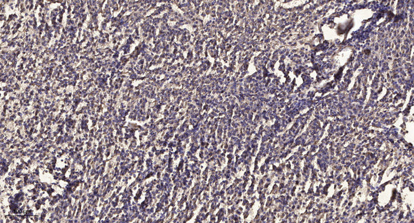 Anti-Phospho-BCL2-Thr74 antibody (STJ91281) – Figure 1 of 1