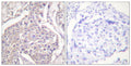 Anti-Phospho-HSPB6-Ser16 antibody (5-54 aa) (STJ91290) – Figure 1 of 1