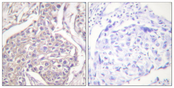 Anti-Phospho-HSPB6-Ser16 antibody (5-54 aa) (STJ91290) – Figure 1 of 1