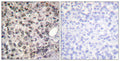 Anti-Phospho-DDX5-Tyr593 antibody (565-614 aa) (STJ91304) – Figure 1 of 1