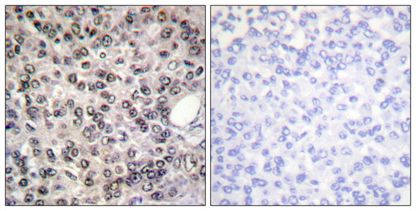 Anti-Phospho-DDX5-Tyr593 antibody (565-614 aa) (STJ91304) – Figure 1 of 1