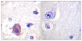 Anti-Phospho-PTK2-Ser910 antibody (876-925 aa) (STJ91306) – Figure 1 of 1