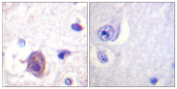 Anti-Phospho-PTK2-Ser910 antibody (876-925 aa) (STJ91306) – Figure 1 of 1