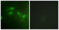 Anti-Phospho-MDM2-Ser186/S188 antibody (151-200 aa) (STJ91352) – Figure 1 of 1