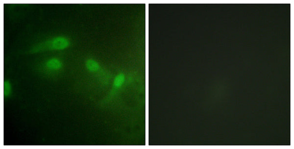Anti-Phospho-MDM2-Ser186/S188 antibody (151-200 aa) (STJ91352) – Figure 1 of 1