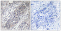 Anti-EIF4EBP1 antibody (13-62 aa) (STJ91383) – Figure 1 of 1